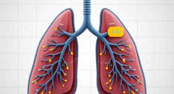APAC Unites to Combat Lung Cancer: Regional Policy Consensus